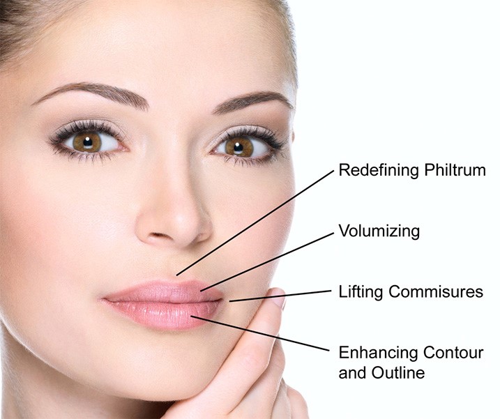 Juvederm Volbella | skin care | Novique Medical Aesthetics | Doylestown, PA