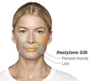 Restylane Line | skin care | Novique Medical Aesthetics | Doylestown, PA