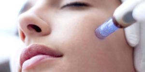 Microneedling PRP | skin care | Novique Medical Aesthetics | Doylestown, PA