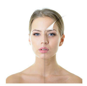 Chemical Peel | skin care | Novique Medical Aesthetics | Doylestown, PA