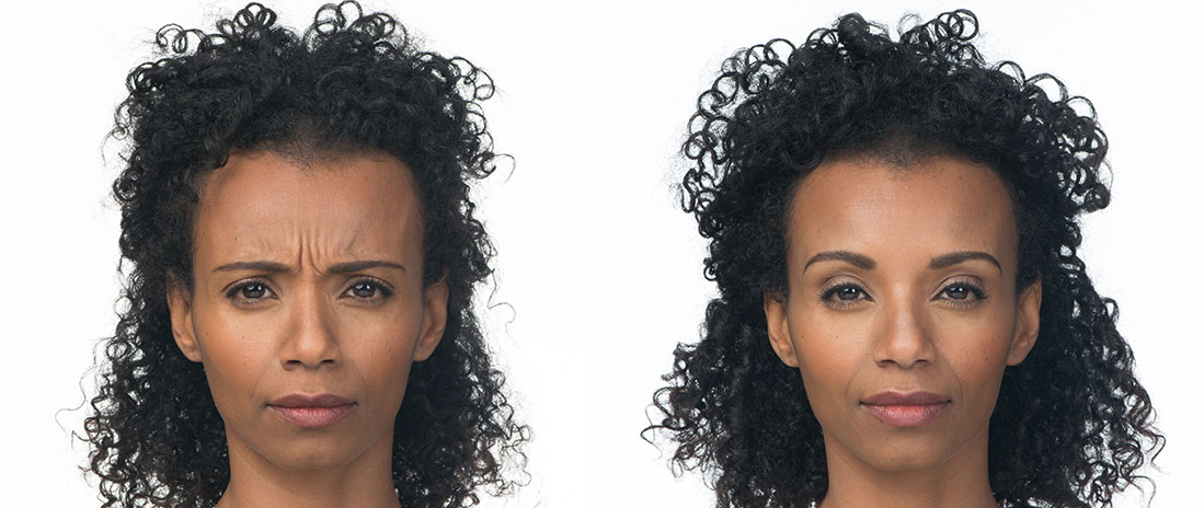 Botox Before & After Doylestown & Bucks County, PA Botox Before & After | skin care | Novique Medical Aesthetics | Doylestown, PA