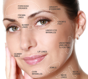 Botox | skin care | Novique Medical Aesthetics | Doylestown, PA
