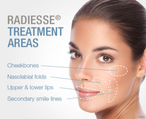 Radiesse | skin care | Novique Medical Aesthetics | Doylestown, PA