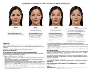 Juvederm | skin care | Novique Medical Aesthetics | Doylestown, PA