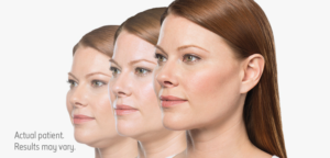 Fat Reduction | skin care | Novique Medical Aesthetics | Doylestown, PA