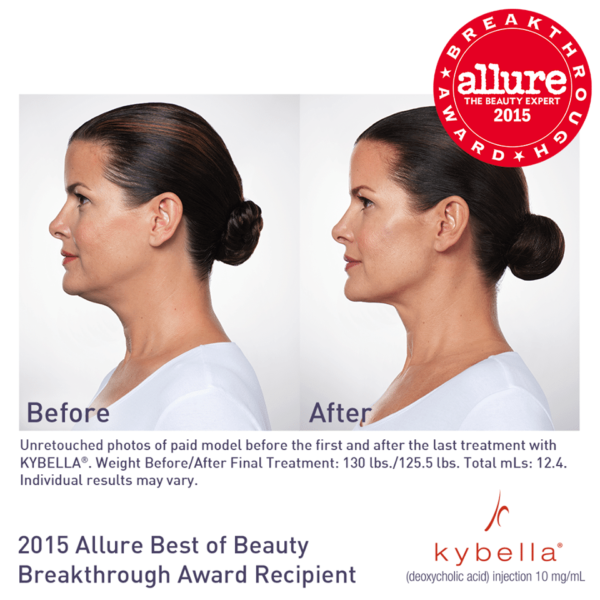 KYBELLA Treatment | skin care | Novique Medical Aesthetics | Doylestown, PA