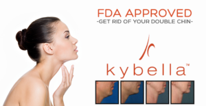 Kybella | skin care | Novique Medical Aesthetics | Doylestown, PA