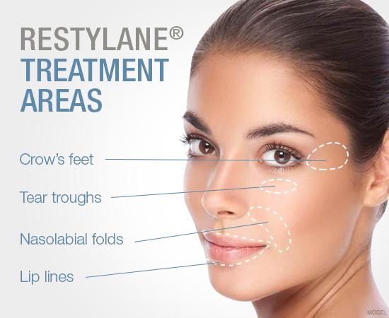Restylane Treatment | skin care | Novique Medical Aesthetics | Doylestown, PA