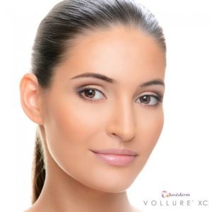 juvederm vollure | skin care | Novique Medical Aesthetics | Doylestown, PA